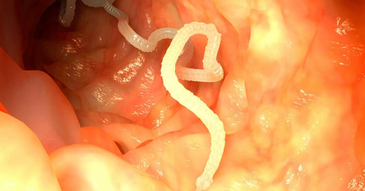 Anzeichen einer Helminthiasis