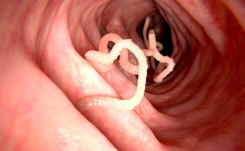 Würmer im menschlichen Körper