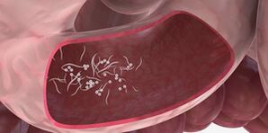 Die Verwendung von Billionen zur Beseitigung von Parasiten