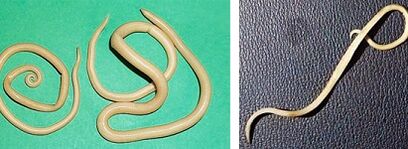 Welche Parasiten kann ein Mensch haben