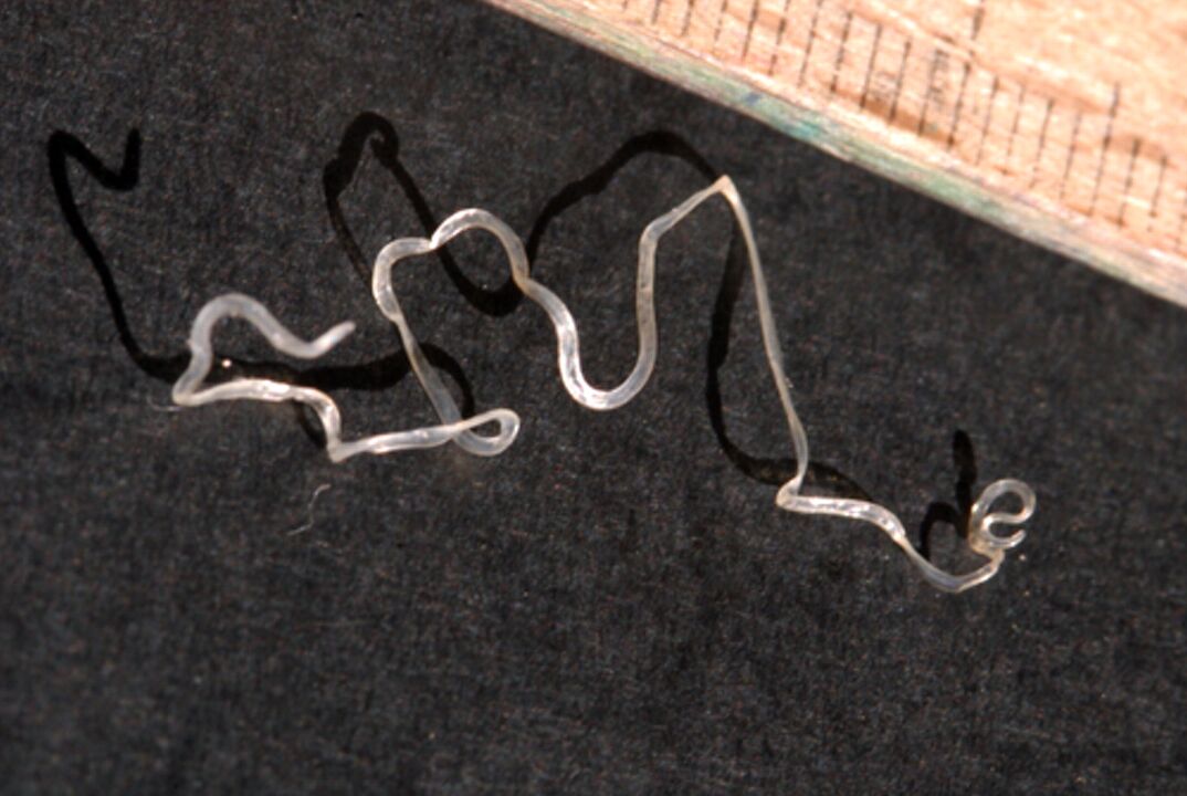 Herzwurm im Körper bei Kindern